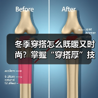冬季穿搭怎么既暖又时尚？掌握“穿搭厚”技巧轻松变美！（图3）